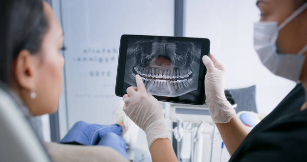 Licensed Wisdom Tooth Removal service in North Carolina, NC - Smile Center Dentistry